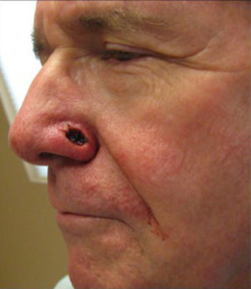 Facial Reconstruction Before & After Gallery - Patient 63360577 - Image 1