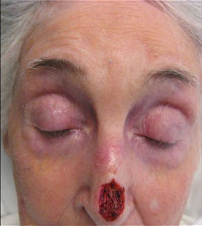 Facial Reconstruction Before & After Gallery - Patient 63360585 - Image 1