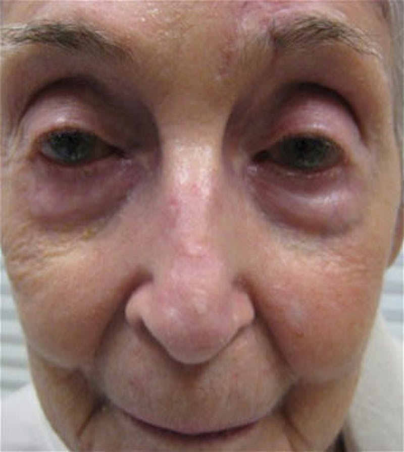Facial Reconstruction Before & After Gallery - Patient 63360585 - Image 2