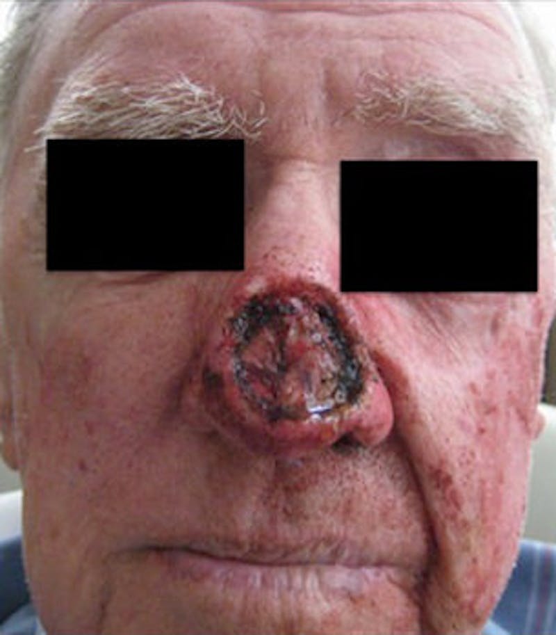 Facial Reconstruction Before & After Gallery - Patient 63360586 - Image 1