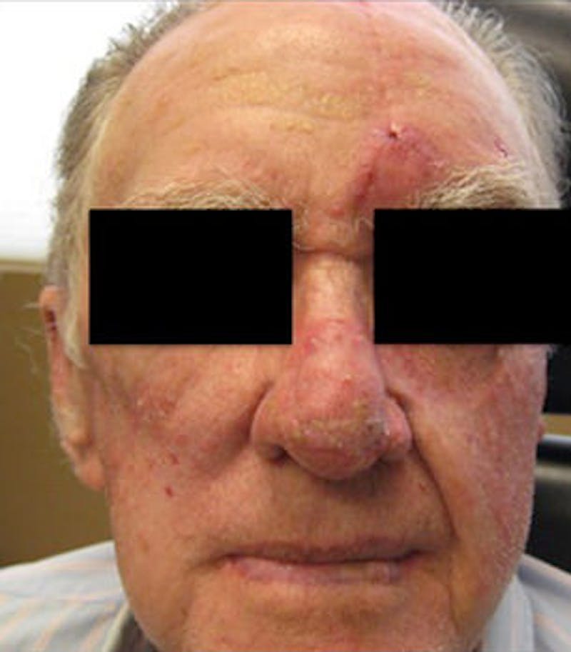 Facial Reconstruction Before & After Gallery - Patient 63360586 - Image 2
