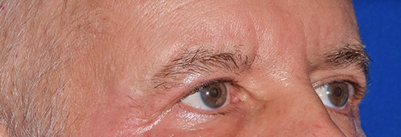 Face Before & After Gallery - Patient 63360966 - Image 4