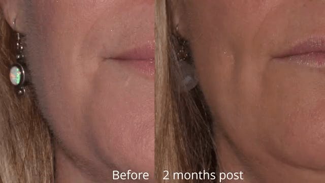 Robb Facial Plastic Surgery
