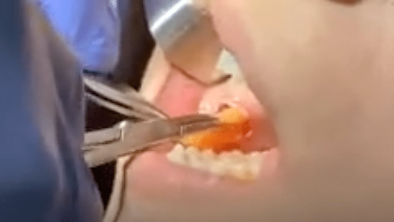Robb Facial Plastic Surgery