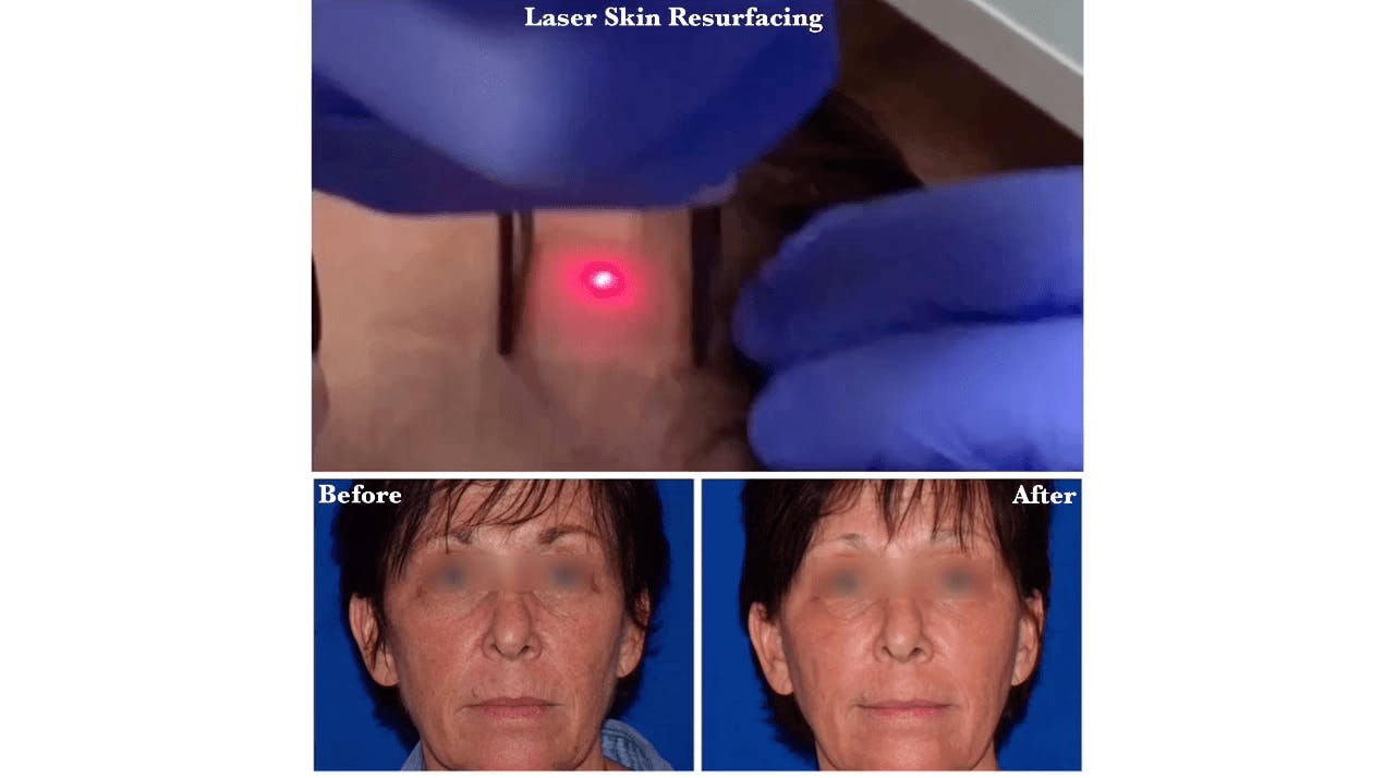 Robb Facial Plastic Surgery
