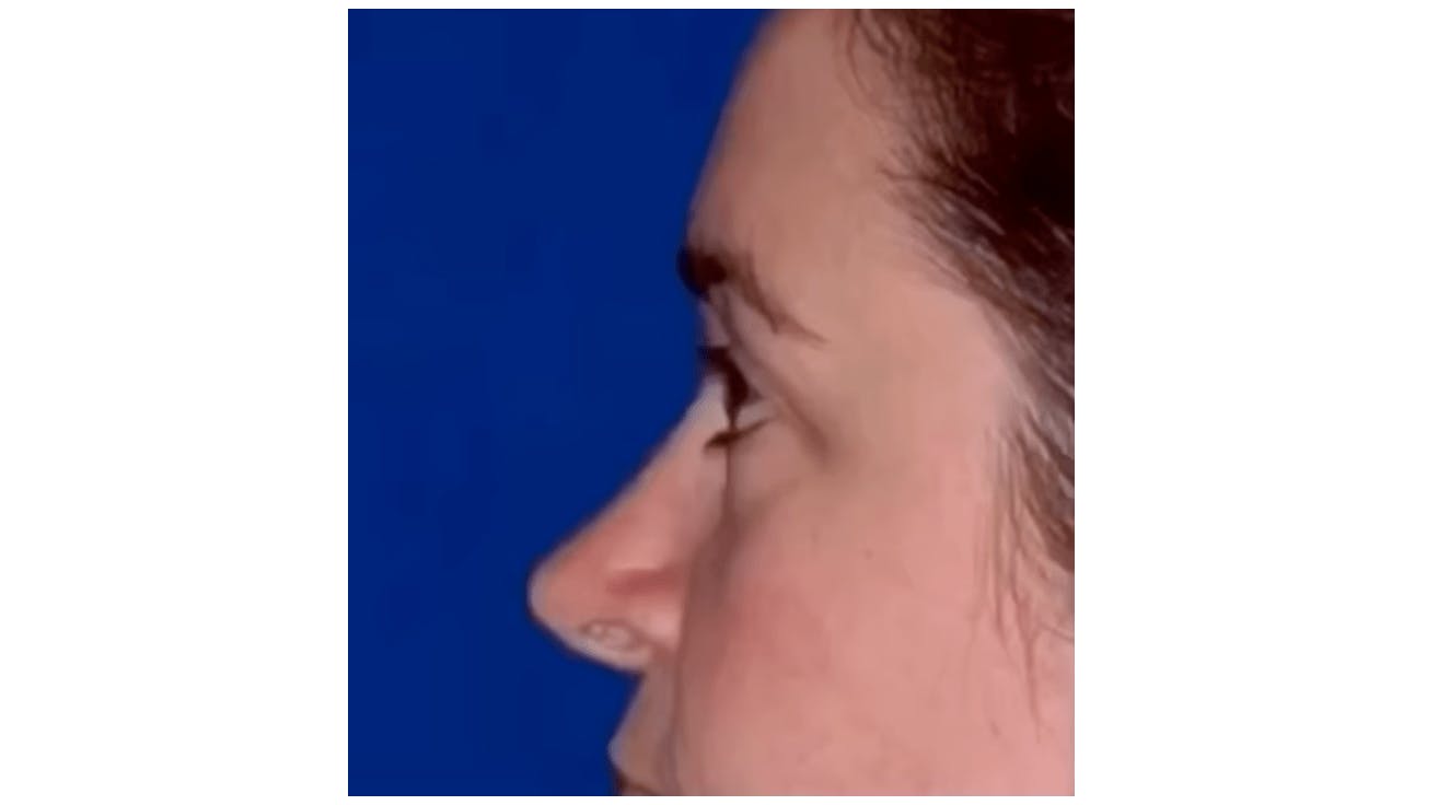 Robb Facial Plastic Surgery