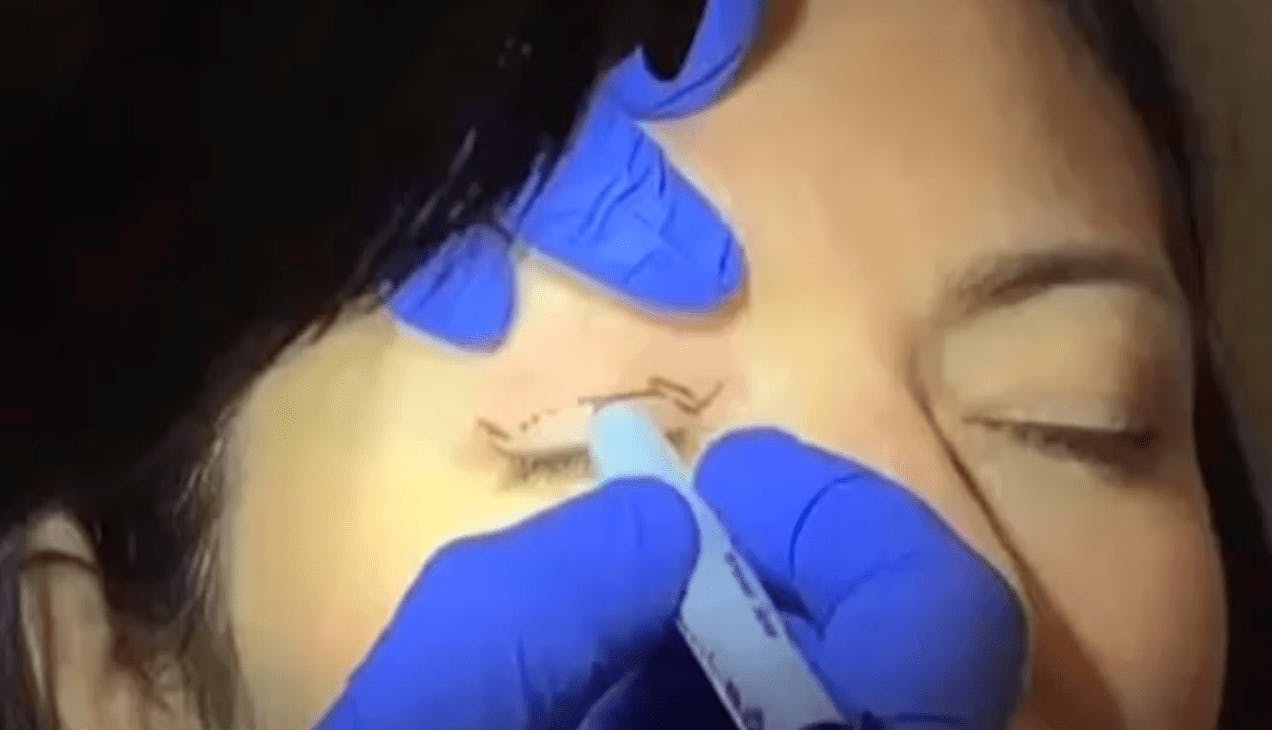 Robb Facial Plastic Surgery