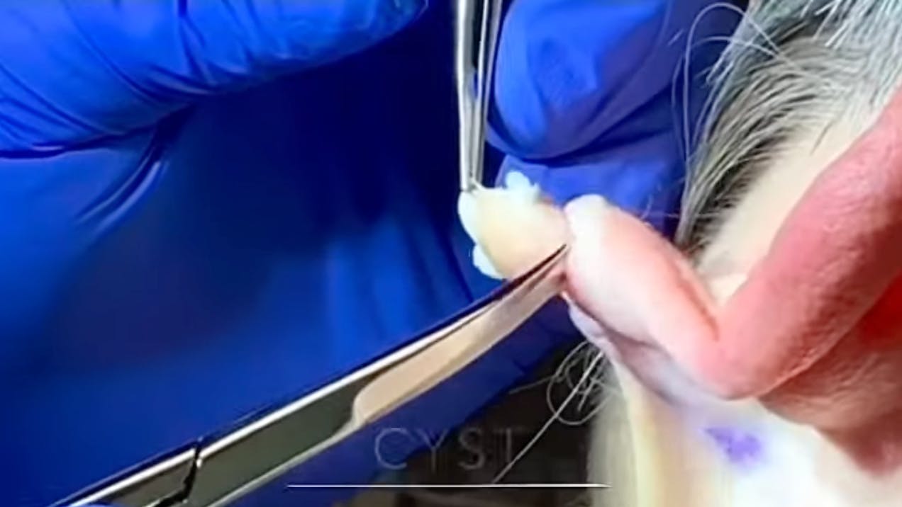 Robb Facial Plastic Surgery
