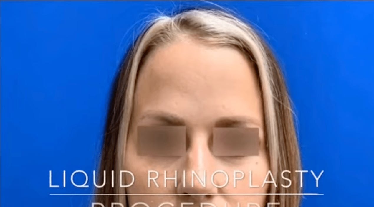 Robb Facial Plastic Surgery