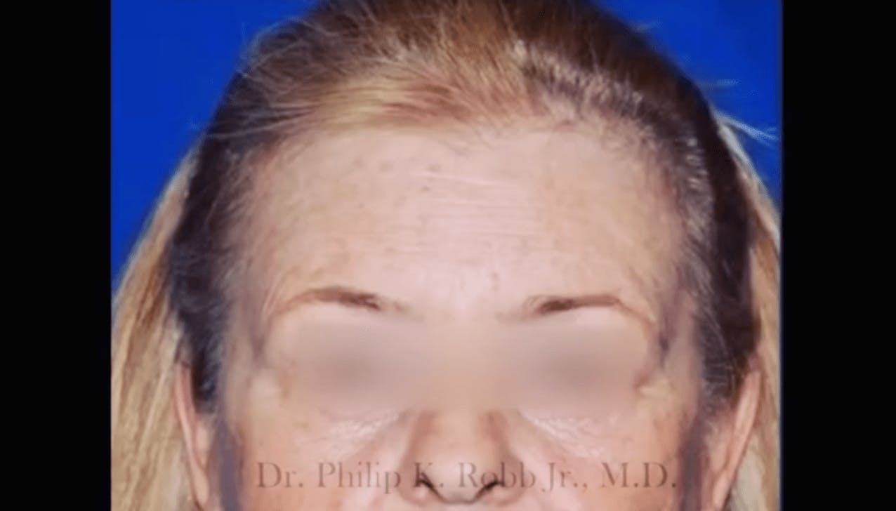Robb Facial Plastic Surgery