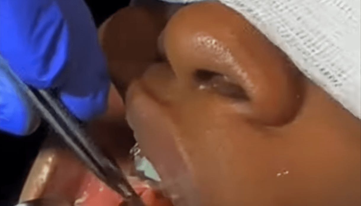 Robb Facial Plastic Surgery
