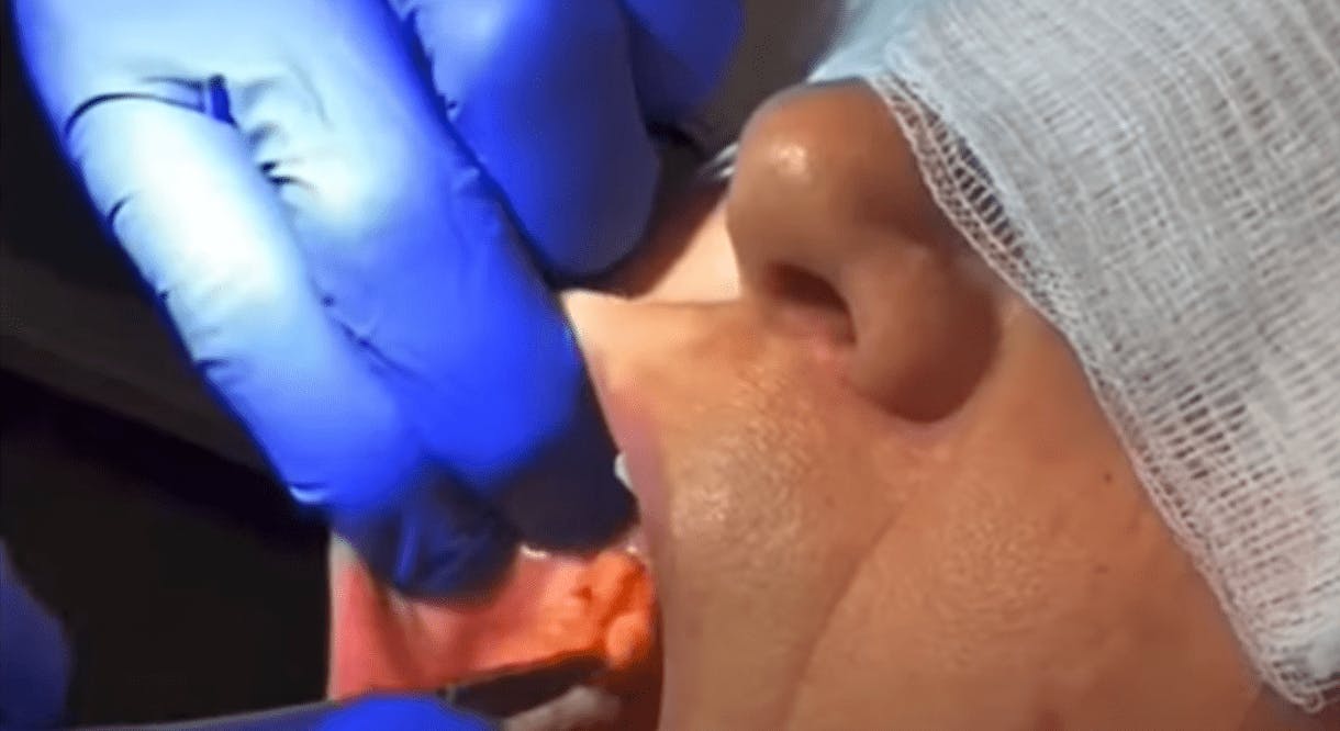 Robb Facial Plastic Surgery