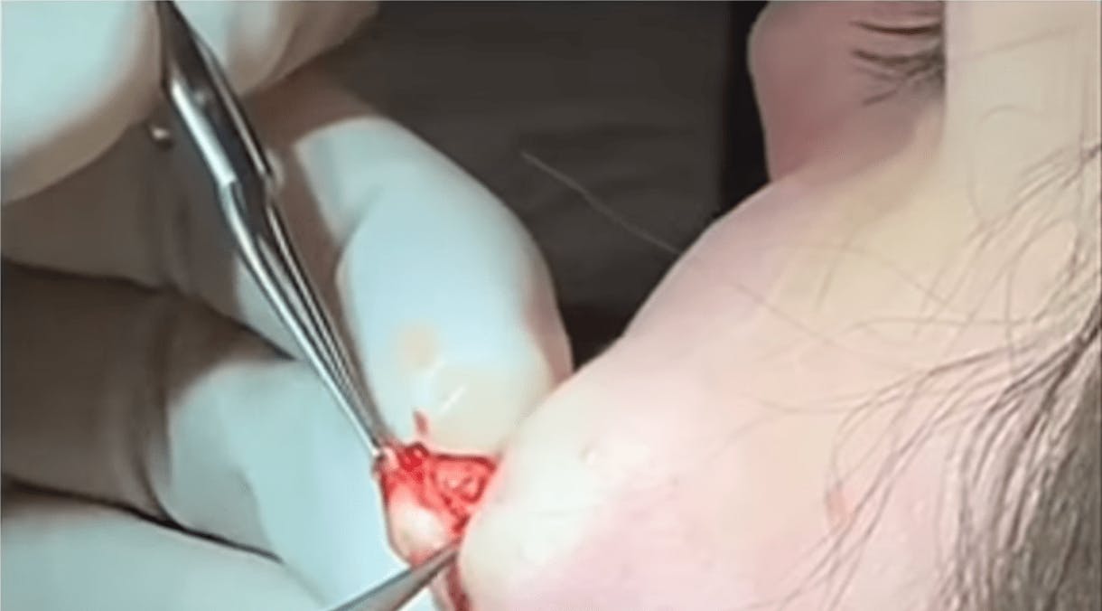 Robb Facial Plastic Surgery