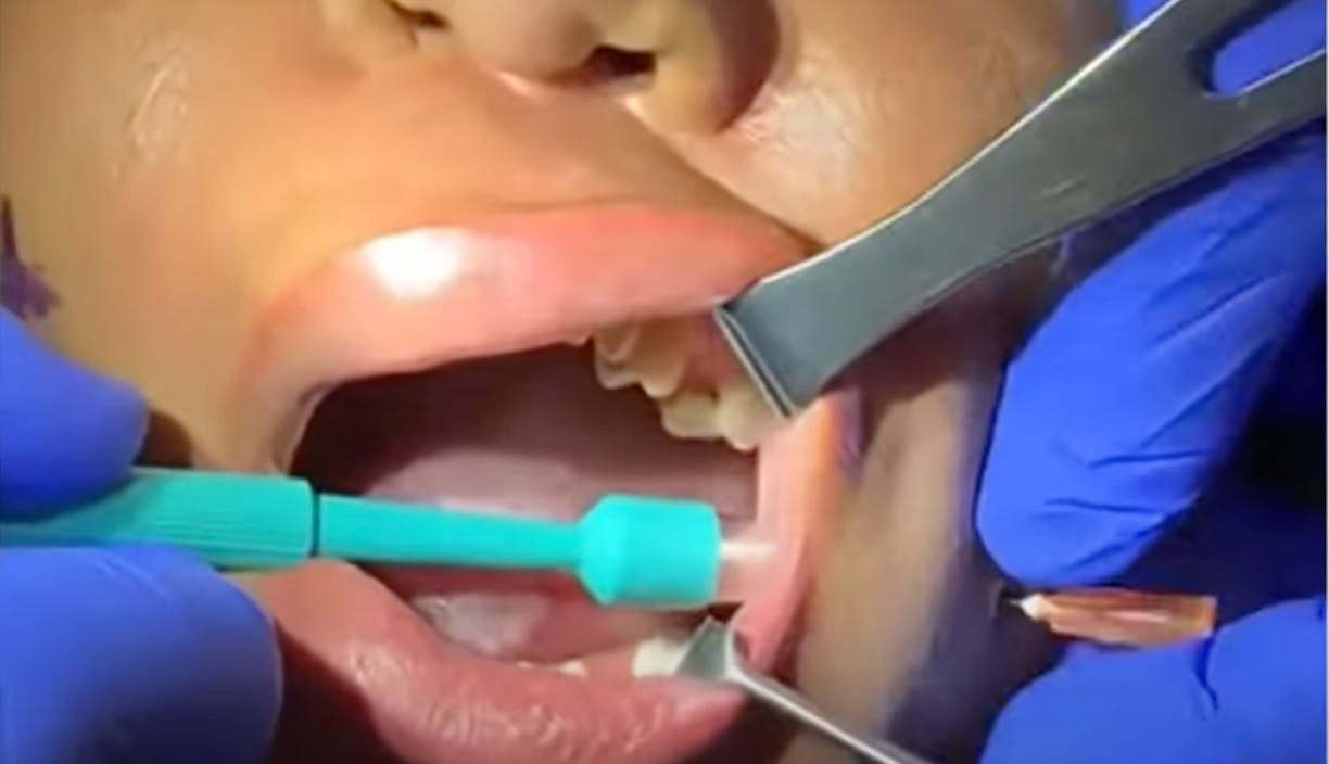 Robb Facial Plastic Surgery