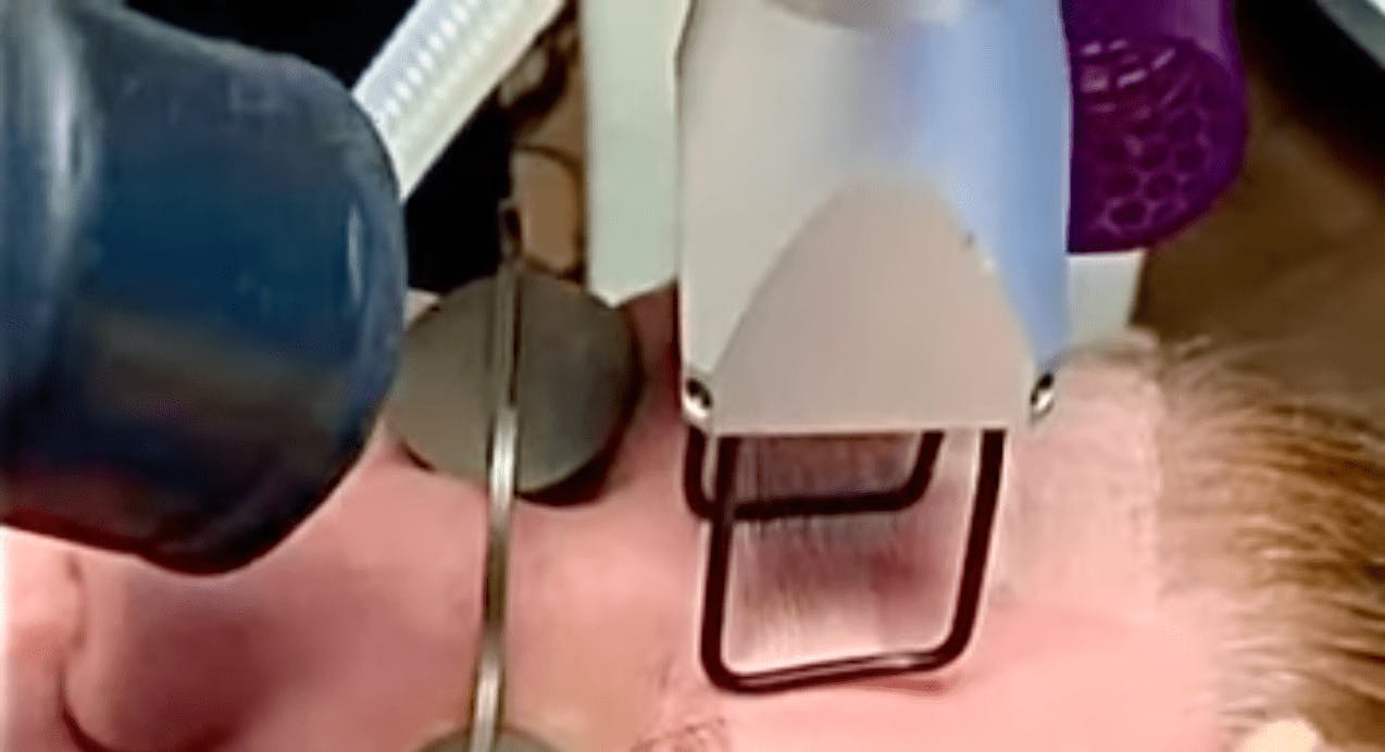 Robb Facial Plastic Surgery