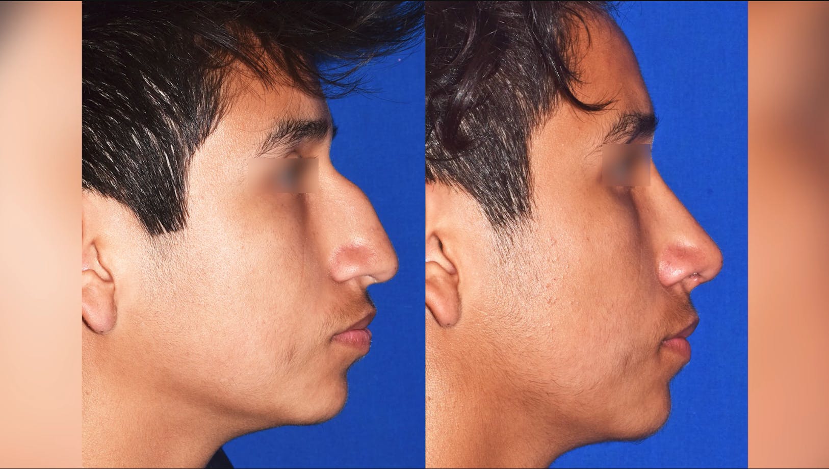 Robb Facial Plastic Surgery