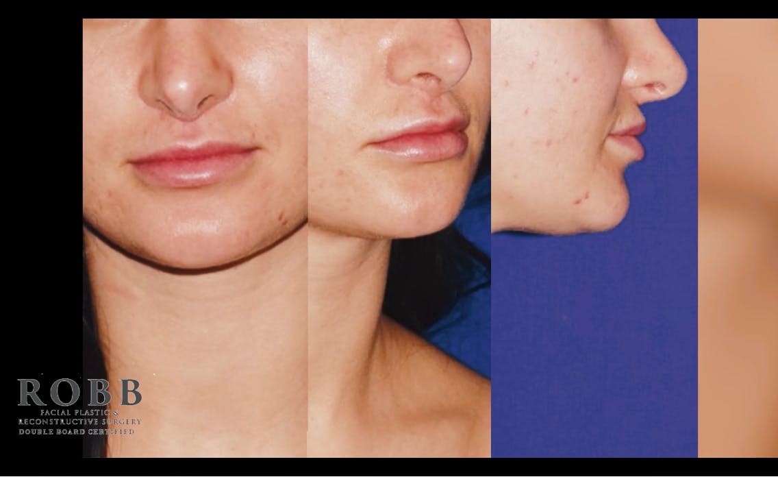Robb Facial Plastic Surgery
