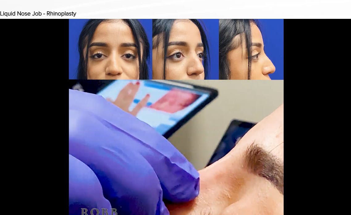 Robb Facial Plastic Surgery