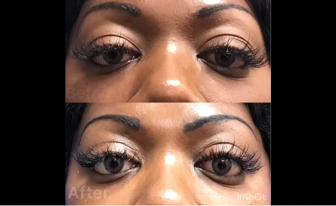 Robb Facial Plastic Surgery