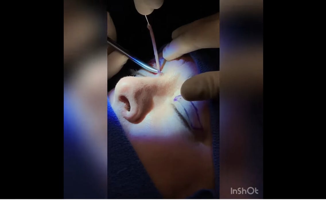 Robb Facial Plastic Surgery