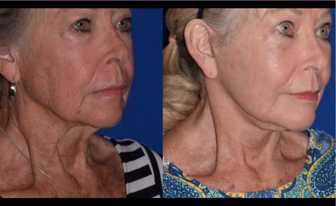 Robb Facial Plastic Surgery