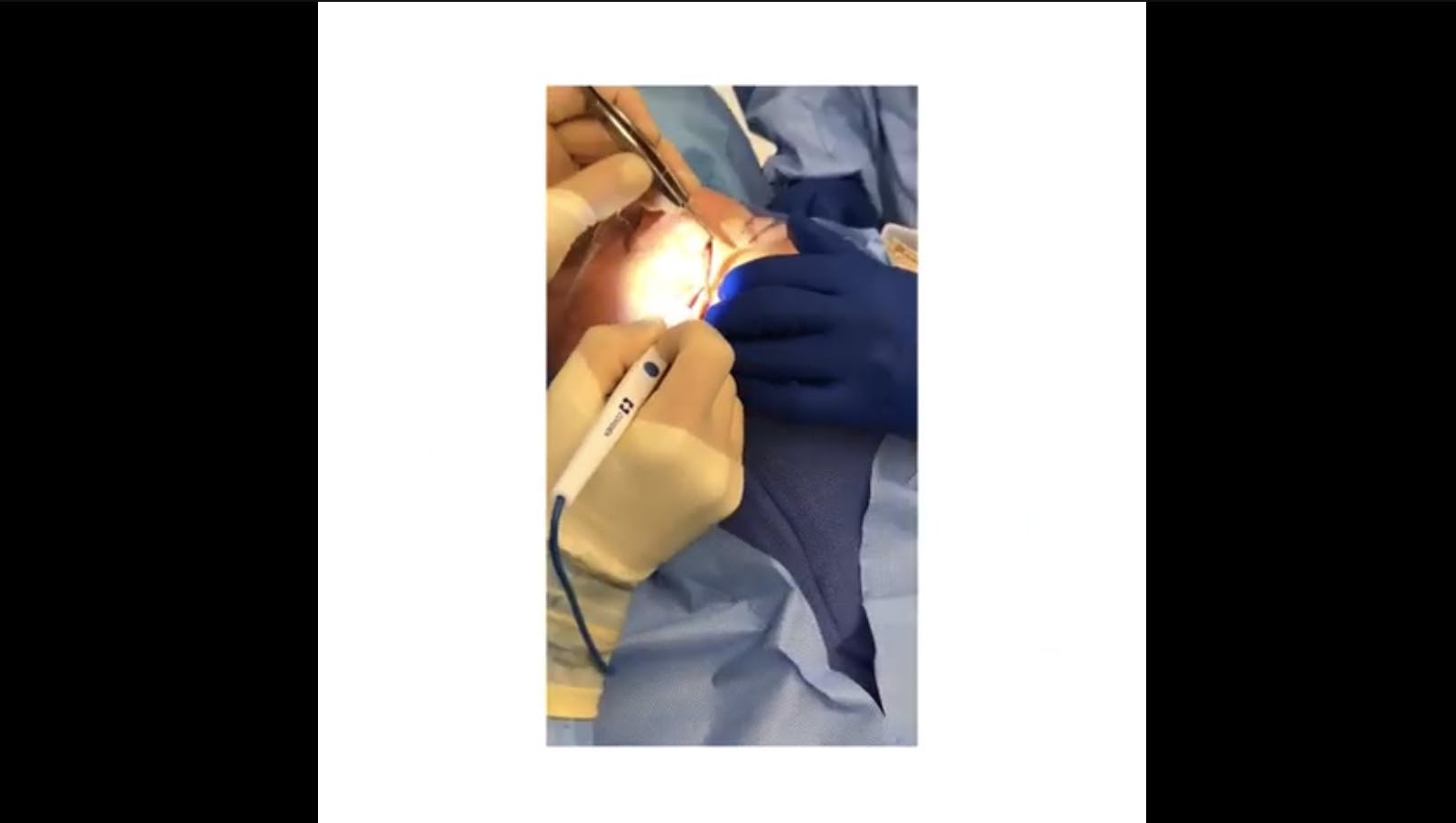 Robb Facial Plastic Surgery