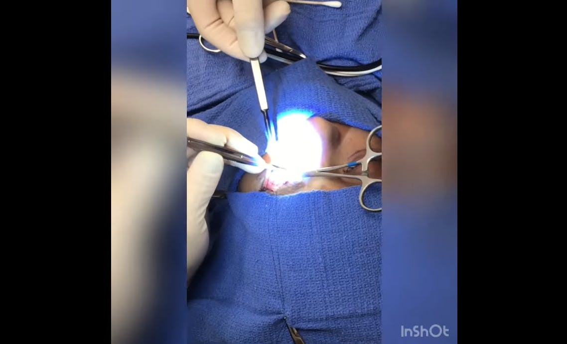 Robb Facial Plastic Surgery