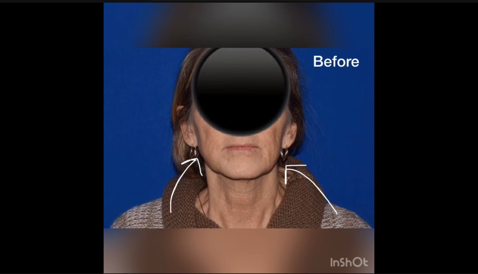 Robb Facial Plastic Surgery