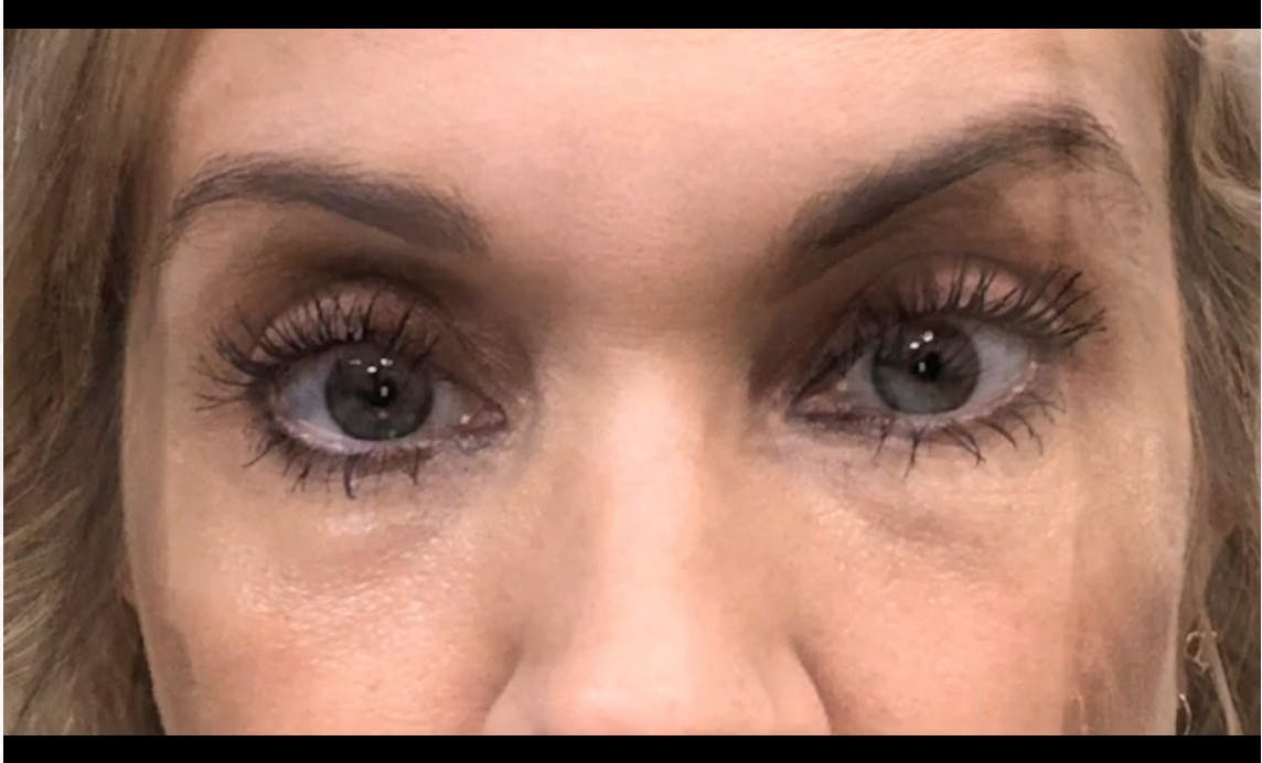 Robb Facial Plastic Surgery