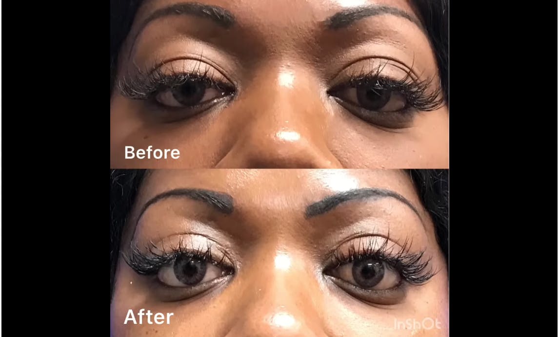 Robb Facial Plastic Surgery