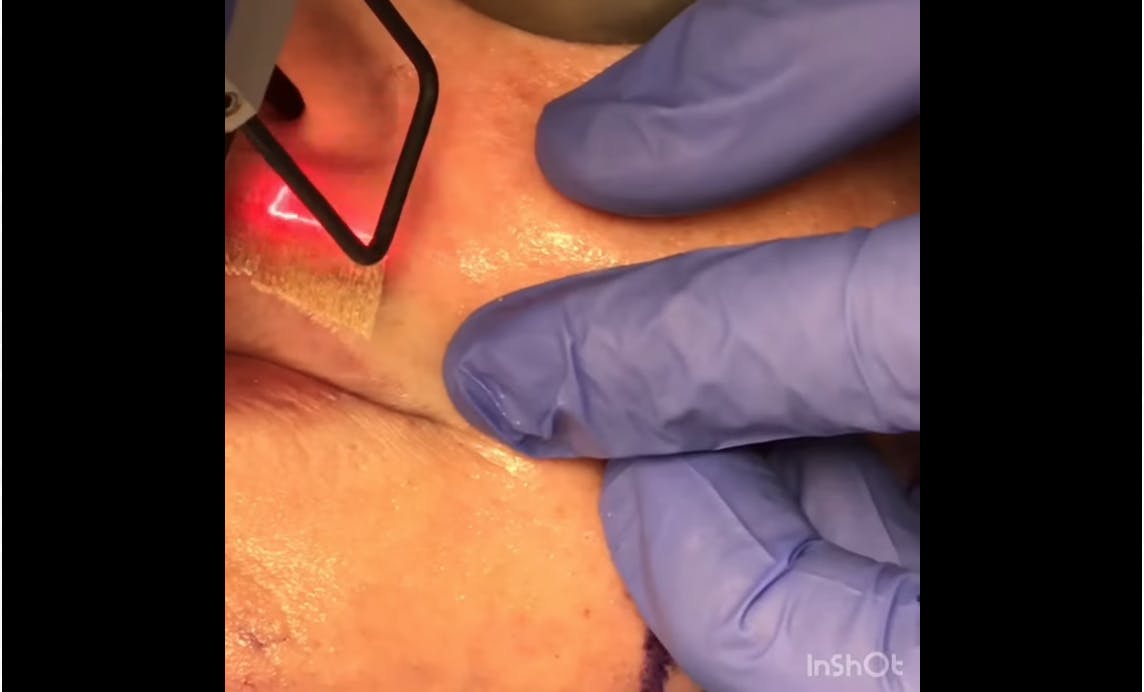 Robb Facial Plastic Surgery