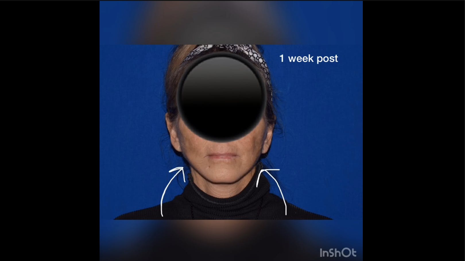 Robb Facial Plastic Surgery