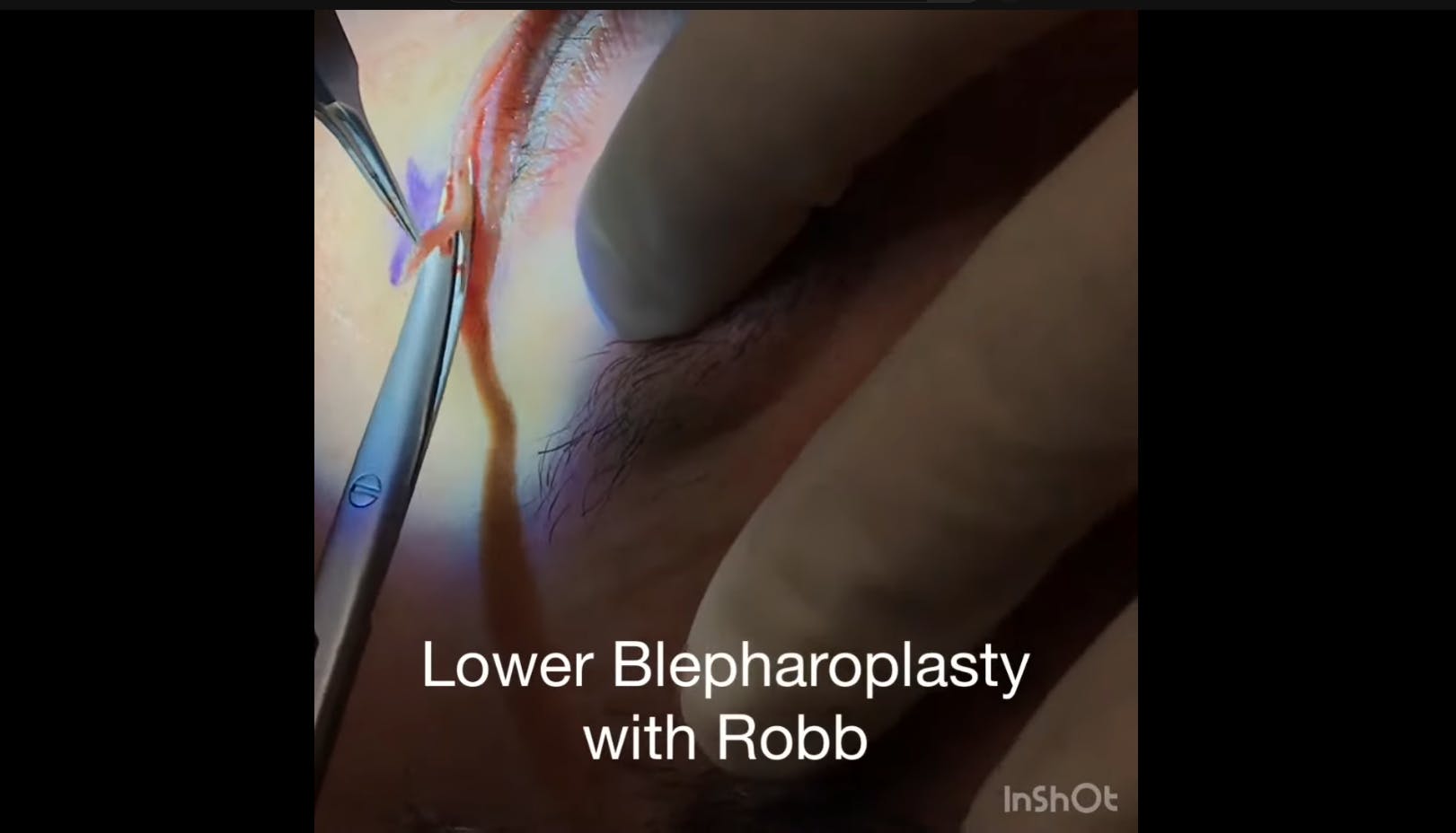 Robb Facial Plastic Surgery