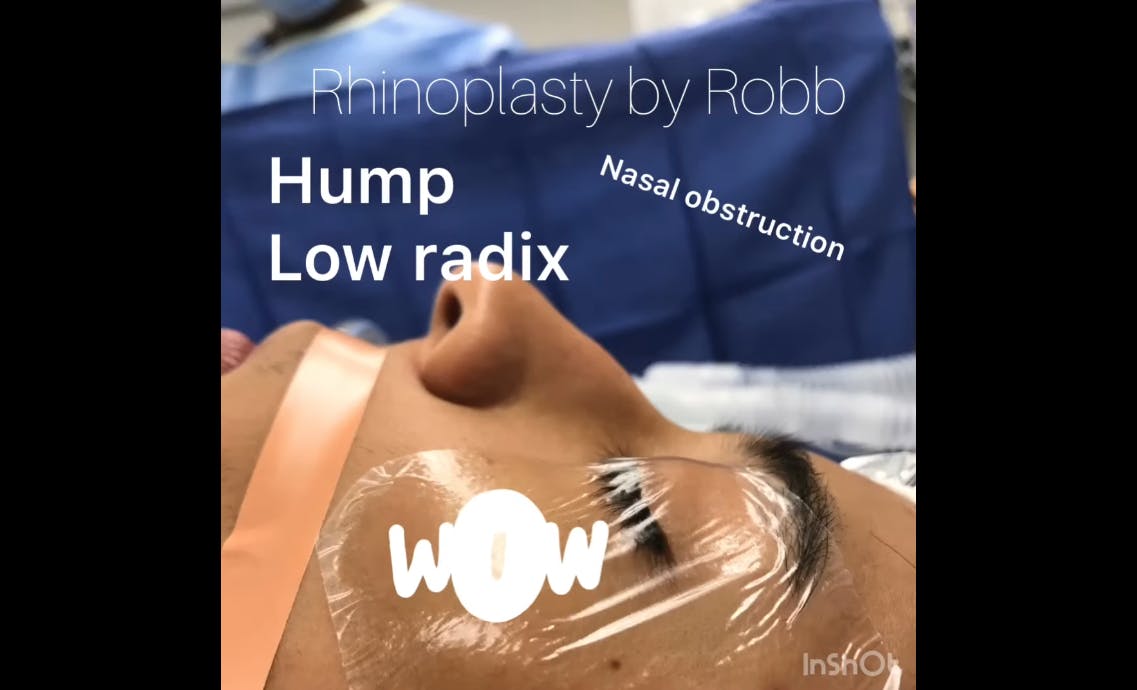 Robb Facial Plastic Surgery