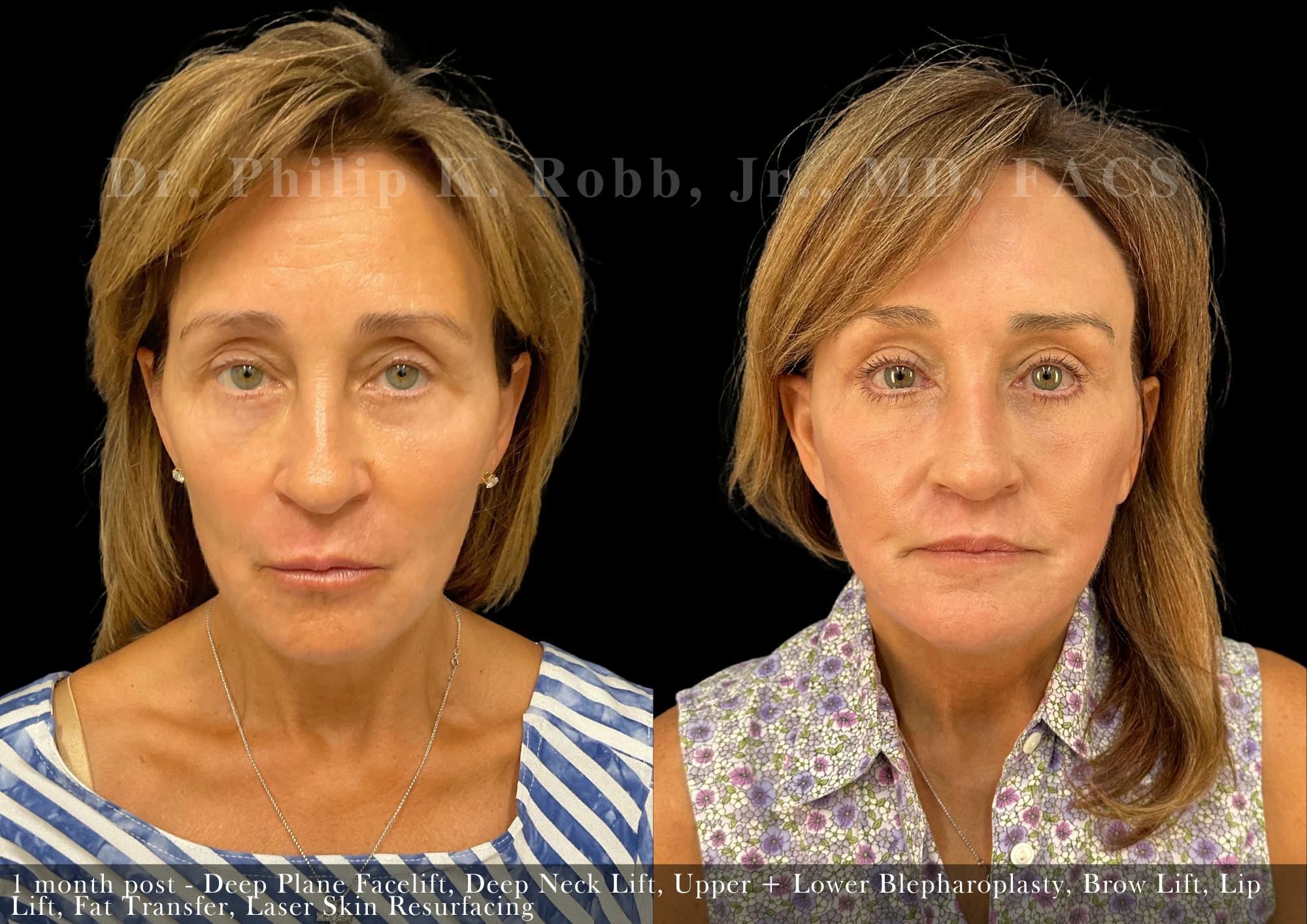 Non-Surgical Before & After Gallery - Patient 205217099 - Image 1