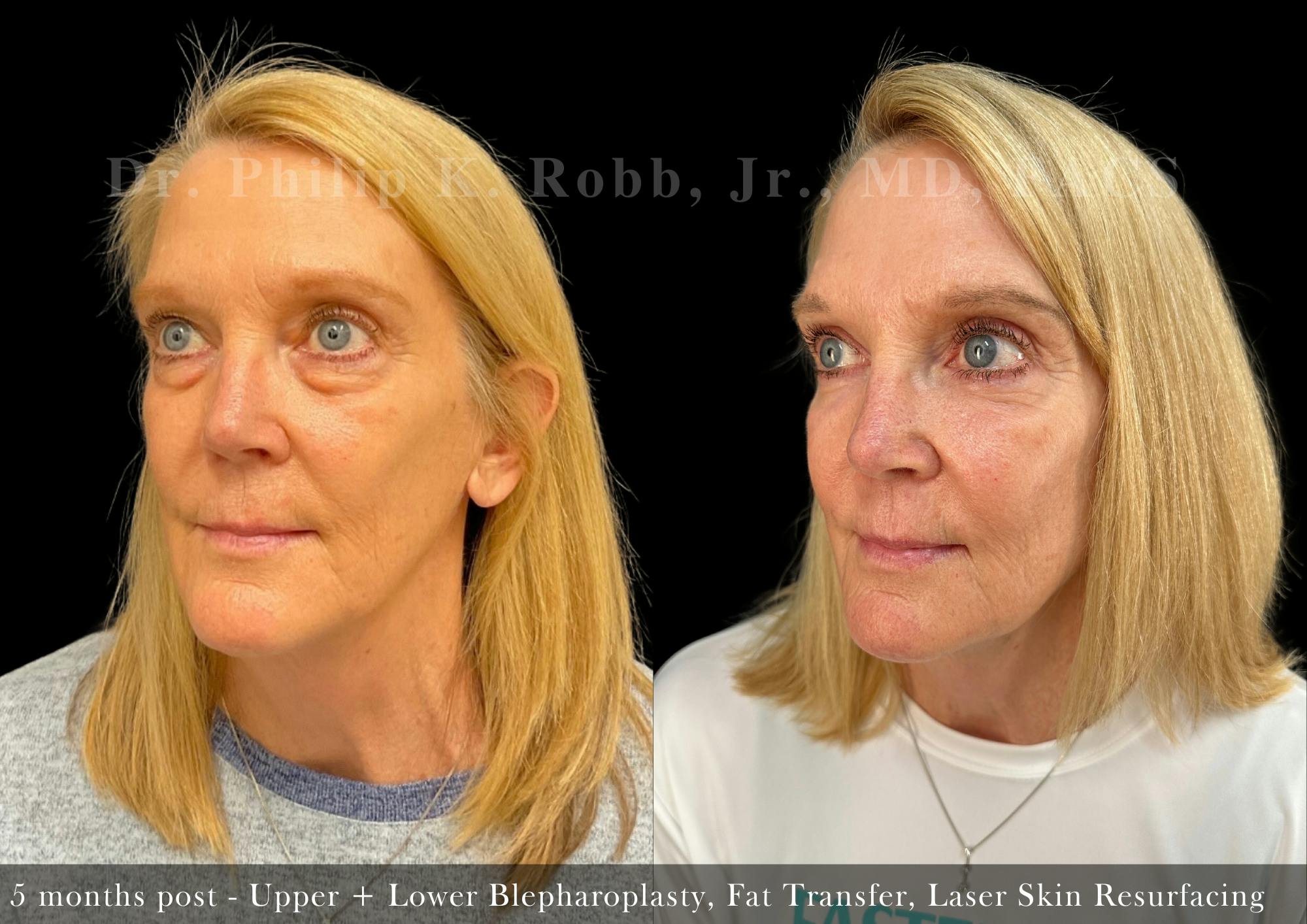 Face Before & After Gallery - Patient 206653770 - Image 2