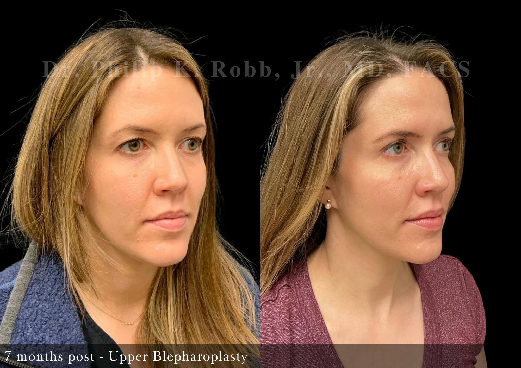 Face Before & After Gallery - Patient 350046 - Image 3