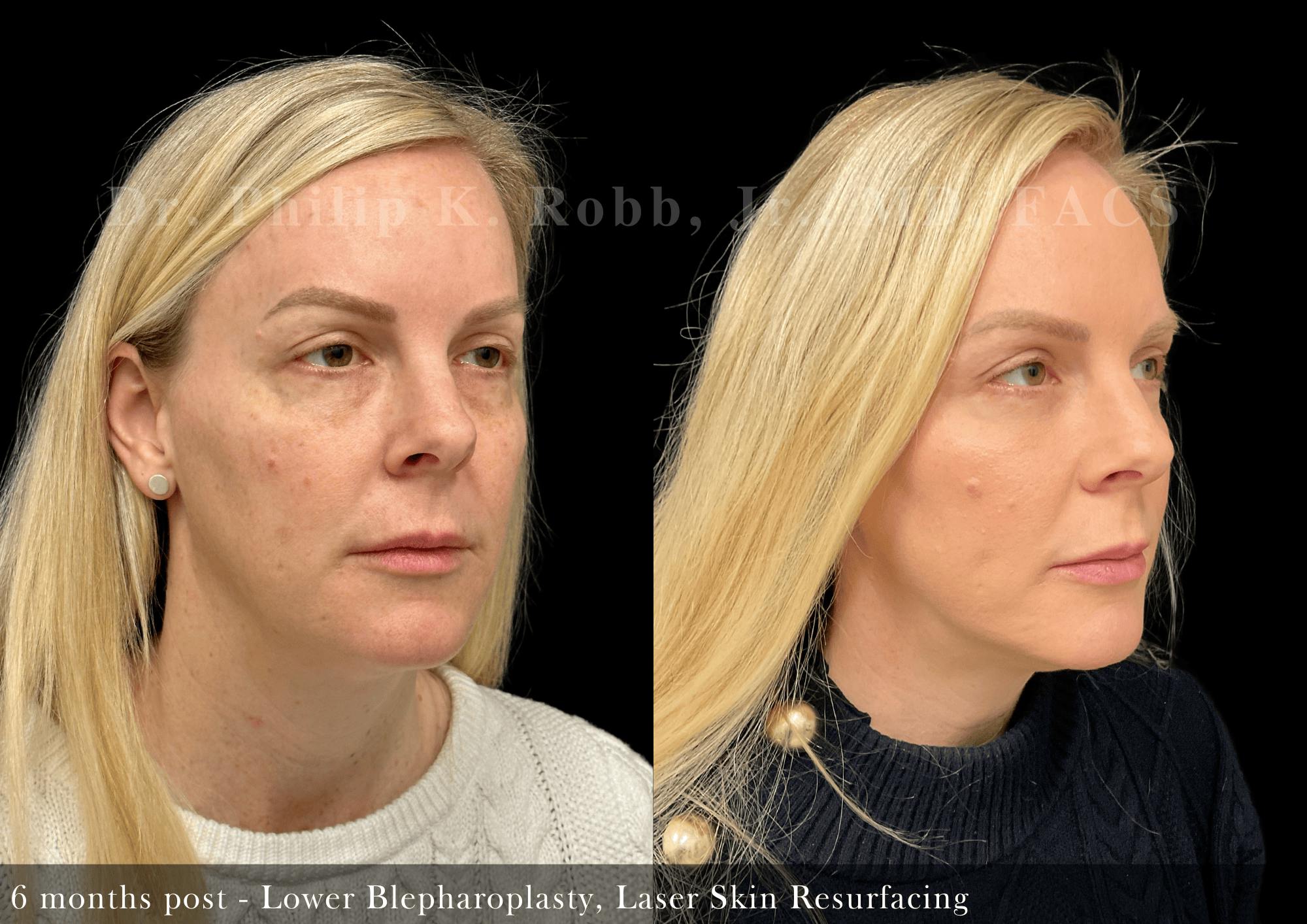 Face Before & After Gallery - Patient 216112 - Image 3