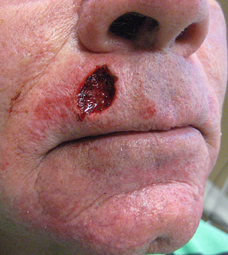 Facial Reconstruction Before & After Gallery - Patient 343366 - Image 1