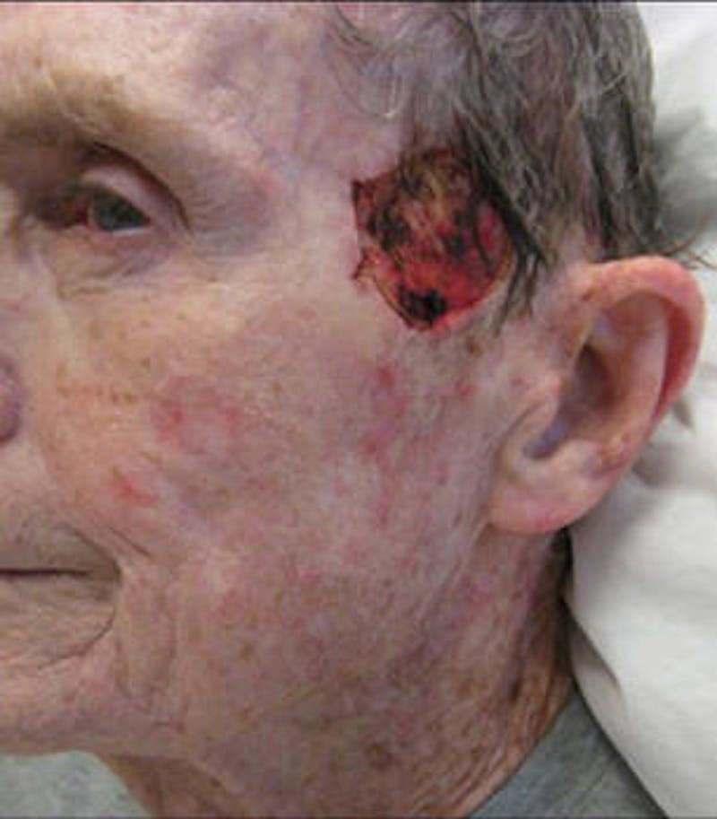 Facial Reconstruction Before & After Gallery - Patient 271119 - Image 1