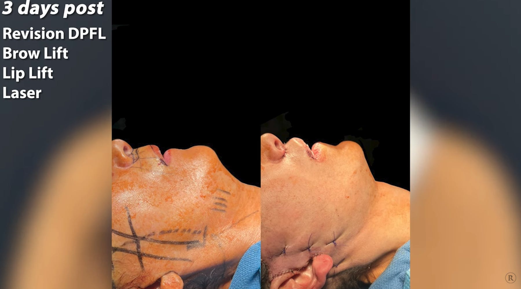 Robb Facial Plastic Surgery