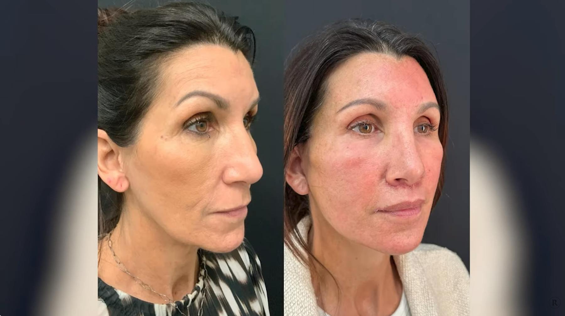 Robb Facial Plastic Surgery