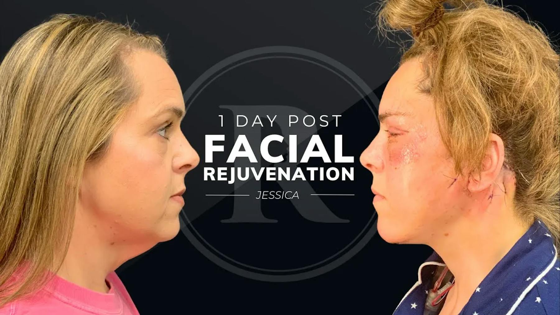 Robb Facial Plastic Surgery