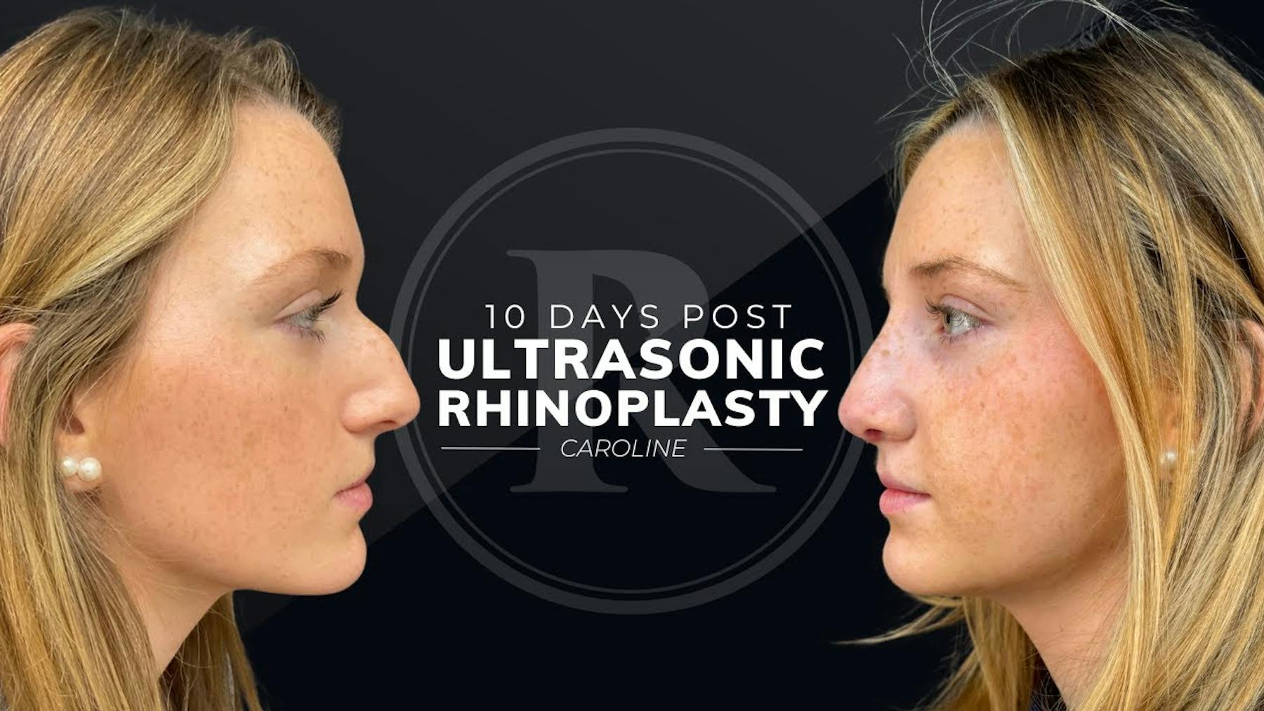 Robb Facial Plastic Surgery