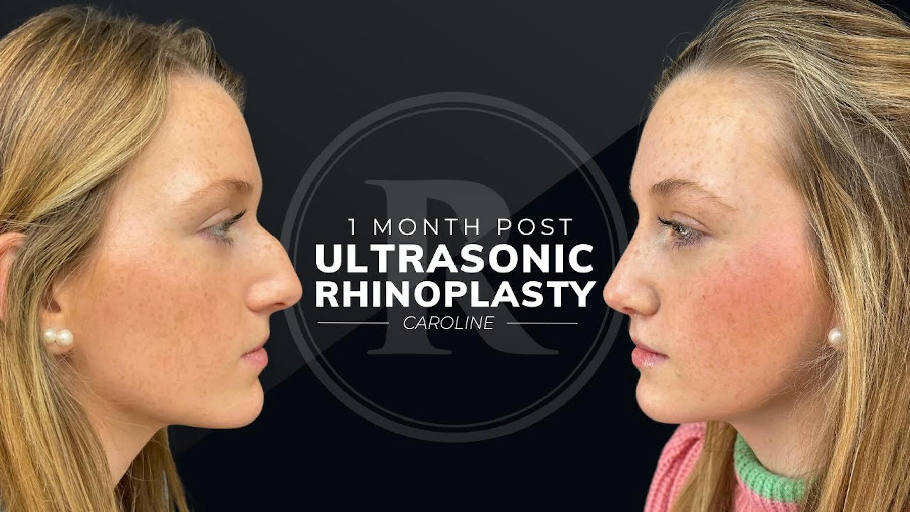 Robb Facial Plastic Surgery