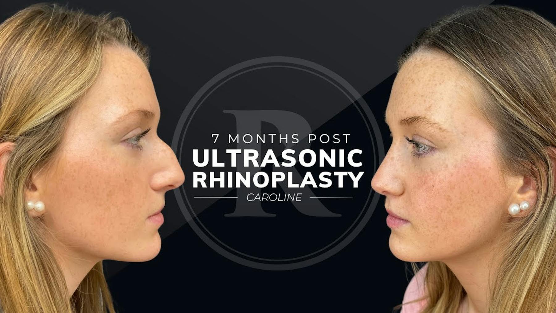 Robb Facial Plastic Surgery