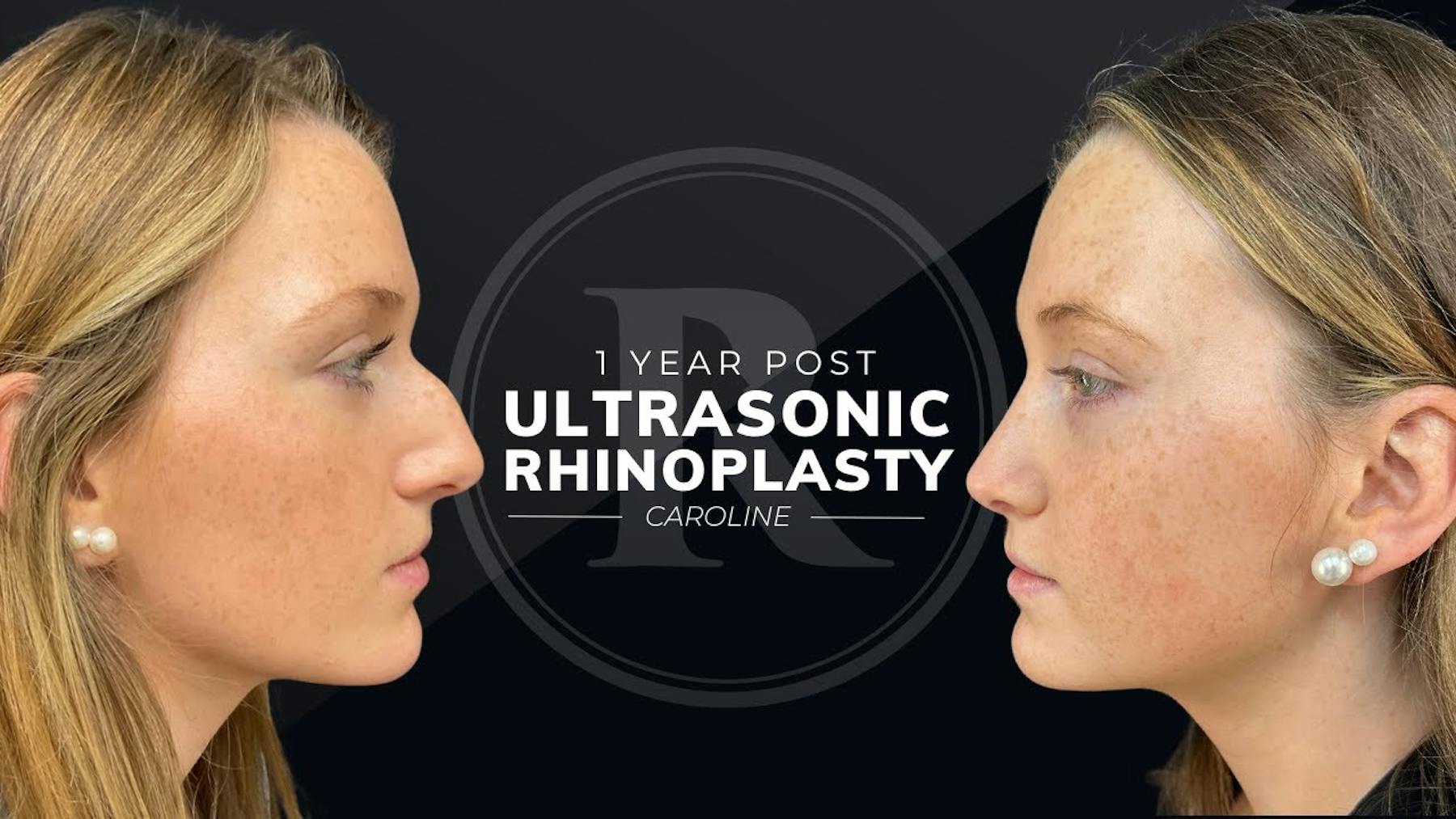 Robb Facial Plastic Surgery