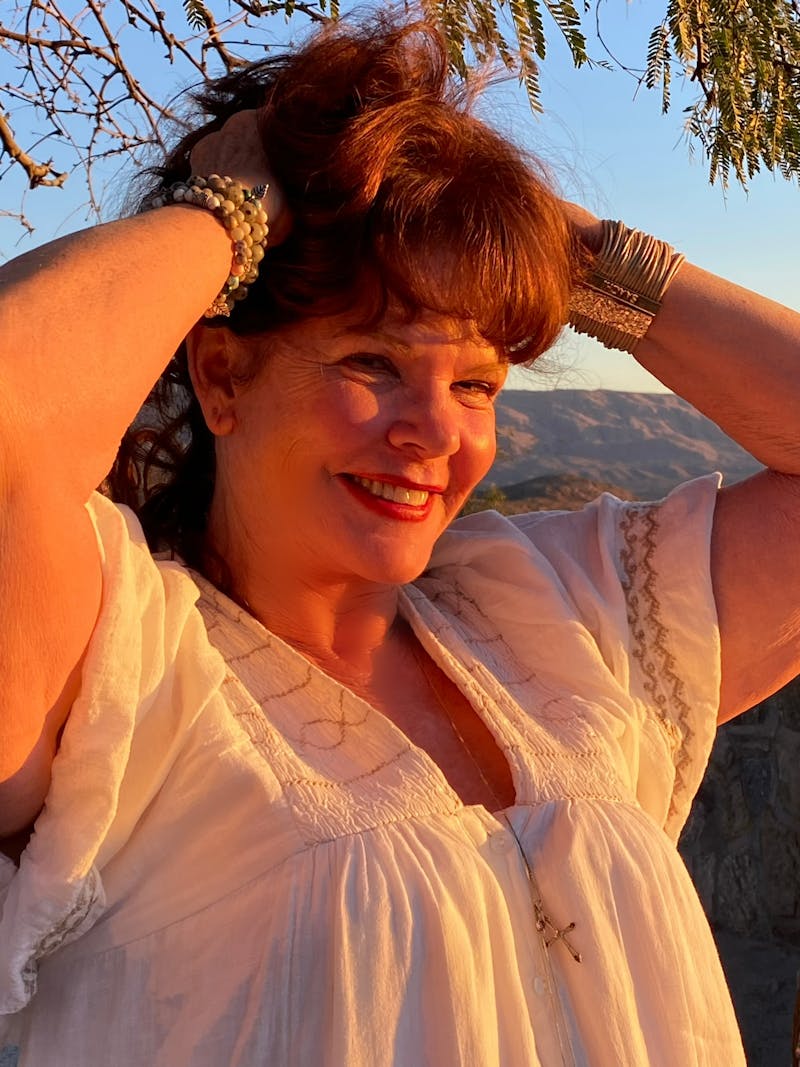 The Robb Refresh Before & After Gallery - Patient 215823 - Image 1