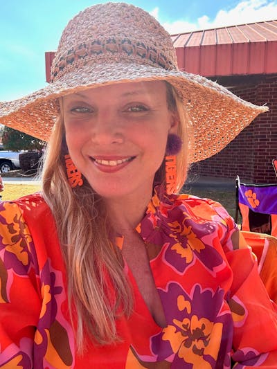 The Robb Refresh Before & After Gallery - Patient 427678 - Image 1