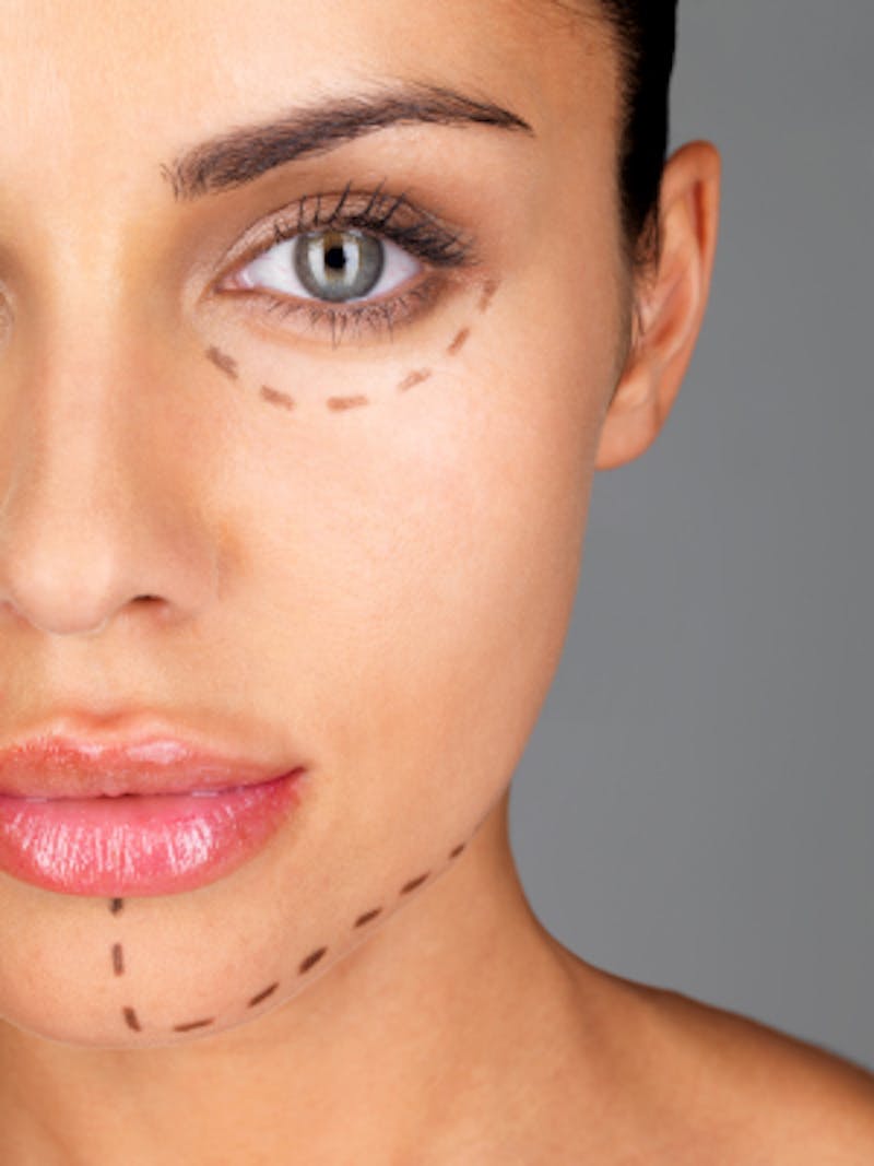 Mini Face Lift vs. Full Face Lift: Which One Is Right For You 